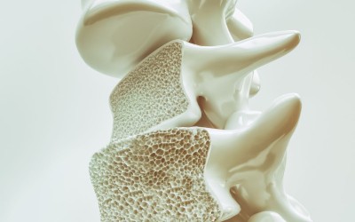 Giải đáp: Uống nước ion kiềm có giúp ngăn ngừa bệnh loãng xương?
